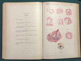 <strong>Histologie pathologique de l'oeil. Avec 20 planches dessinées d'après nature. </strong>